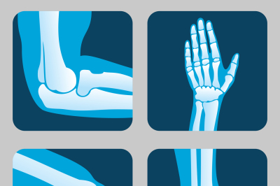 Human joints&2C; knee and elbow&2C; ankle wrist. Medical orthopedic vector s