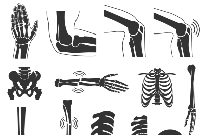 Orthopedic and spine vector black symbols. human bones icons