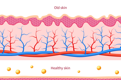 Collagen human skin effect. Close up damaged old and healthy vector me