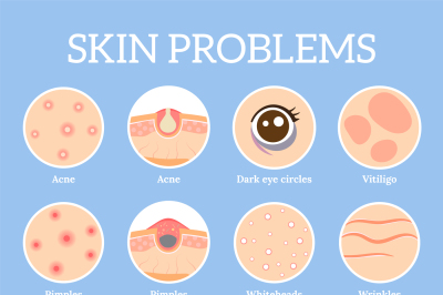 Skin problems. Ages wrinkles problem, face skin infection treatment an