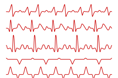 Line vector cardiograms or electrocardiogram on monitor&2C; heartbeat med