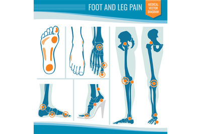 Foot and leg pain. Arthritis and rheumatism orthopedic medical vector