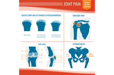 Osteoarthritis and rheumatism joint pain medical vector infographic