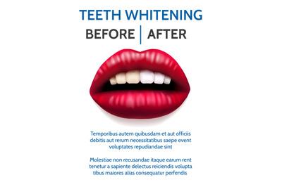 Teeth whitening poster