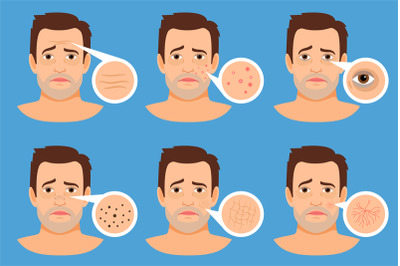 Man skin problems illustration