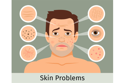 Male facial skin problems