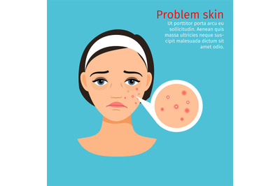 Woman face problem skin with acne