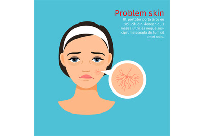 Woman face problem&2C; buried capillaries skin