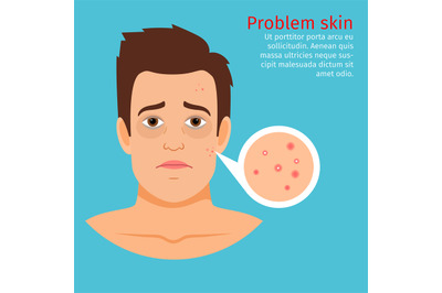 Young man face problem skin acne