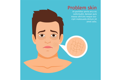 Young man face dry skin problem