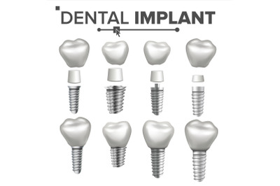 Dental Implant Set Vector. Dental Clinic Stomatology Flyer. Health Tooth Implant. Realistic Isolated Illustration