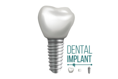 Dental Implant Vector. Molar Human Teeth. Dental Clinic Stomatology Flyer. Realistic Isolated Illustration