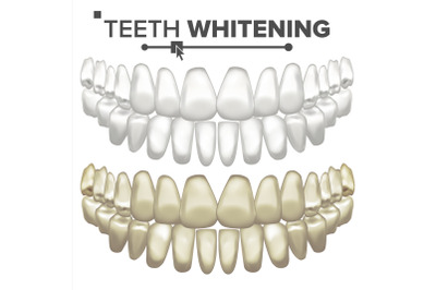 Teeth Whitening Vector. Dental Care. Cleaning Professional Teeth. Realistic Isolated Illustration