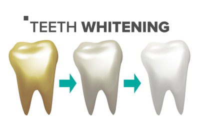 Teeth Whitening Vector. Teeth And Tooth Dental Concept. Healthcare. Realistic Isolated Illustration