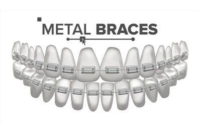 Metal Braces Vector. Human Jaw. Braces On Teeth. Smile With Braces. 3D Realistic Isolated Illustration