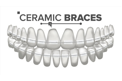 Ceramic Braces Vector. Human Jaw. Dentist, Orthodontist Poster Element. 3D Realistic Isolated Illustration