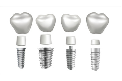 Dental Implant Set Vector. Tooth Set. Dental Health. Stomatology Dentistry. Whitening Design. Realistic Isolated Illustration