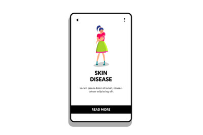 Dermatology Skin Disease Young Woman Hand Vector