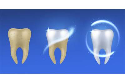 Whitening tooth. Realistic teeth before and after enamel treatment, de