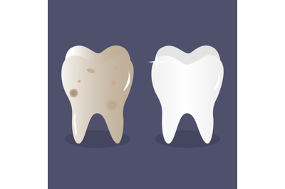 Tooth before and after bleaching and cleaning