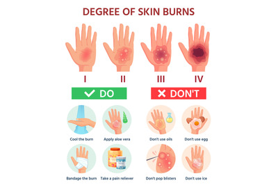 Burns degree. First aid for burn wound. Fire damage to skin classifica