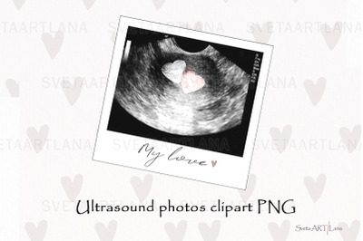 Sublimation PNG Ultrasound Photos