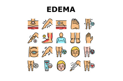 Edema Disease Symptom Collection Icons Set Vector