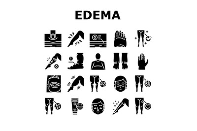 Edema Disease Symptom Collection Icons Set Vector