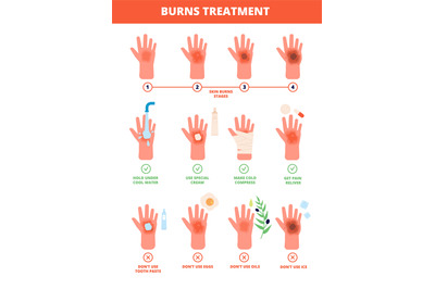 Skin burn. Burned hand treating&2C; protection burns. First aid and treat