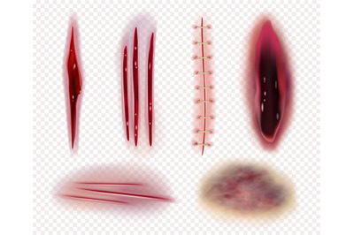 Realistic scars. Cuts wounds bruises bruises blood stitches vector tem