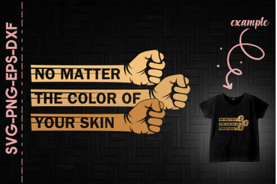 No Matter The Color Of Your Skin