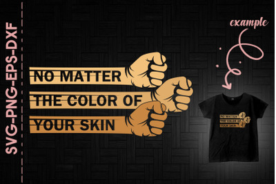 No Matter The Color Of Your Skin