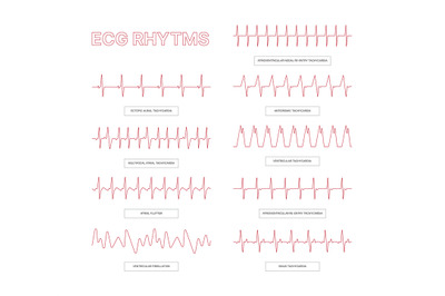 Ecg templates. Medical infographic lines heart arrhythmia health conce