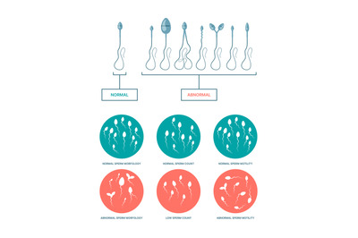 Spermogram. Medical infographic with healthy and damaged spermatozoa b