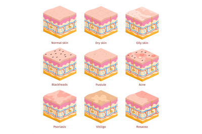 3d human skin types cross section layers. Dry&2C; oily and normal epiderm