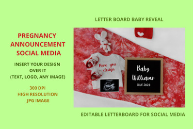 Digital  Baby Announcement  Baby bodysuit