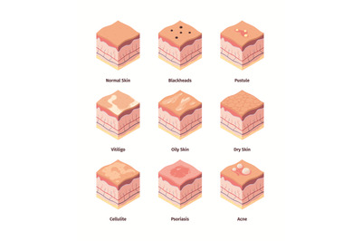 Type of skin. Dermis structure human body cross layers biological illu