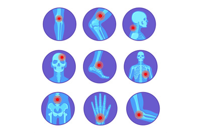 Orthopedic joint diseases. Rheumatoid pain bone knee hand elbow arthri