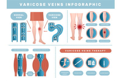 Varicose infographic. Venous disease medical health problems with huma