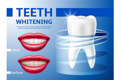 Teeth whitening poster. Realistic 3d smiling lips with perfect result&2C;