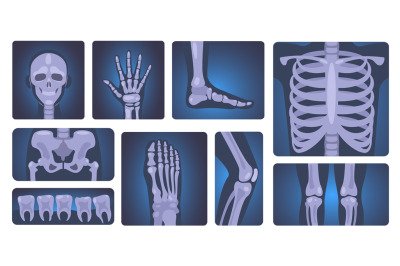 X-ray shots. Human skeleton and body parts&2C; medical diagnosis and heal