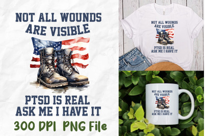 Not All Wounds Are Visible PTSD Veteran