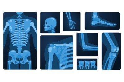 X ray body parts. Human skeleton knee arm chest wrist foot&2C; medical x-