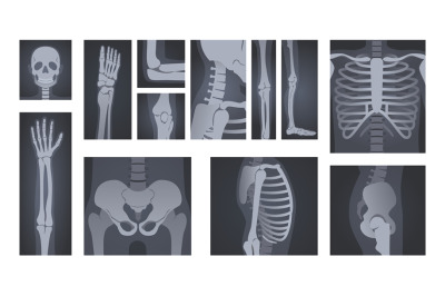 X-ray shots. Human body radiology of head skull, hand bones, spine and