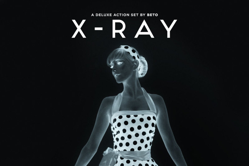 x-ray-action-set