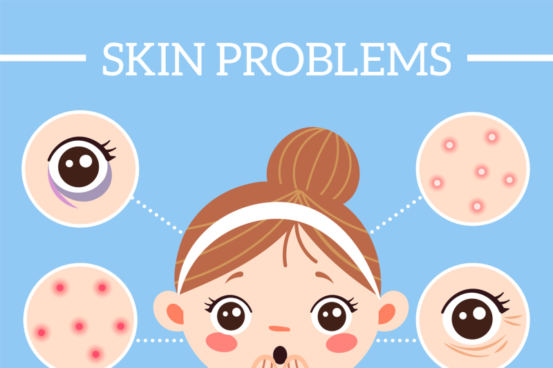 skin-problems-infographic-ages-wrinkles-problems-blackheads-and-clog