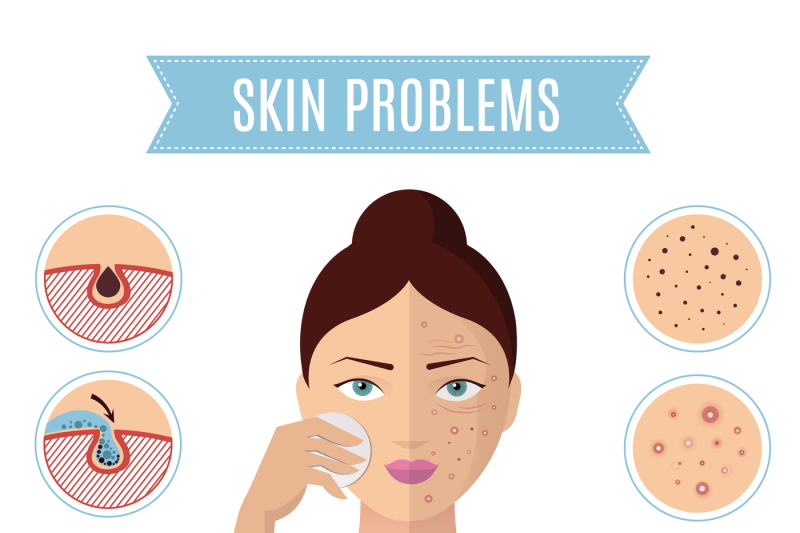 skin-problem-solving-acne-treatment-and-cleansing-pore-for-perfect-wo