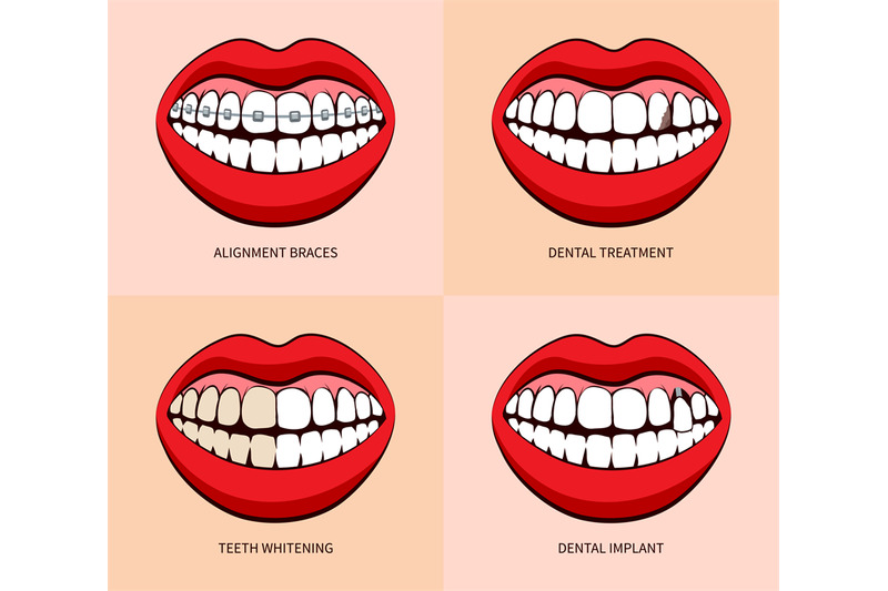 dentist-service-and-teeth-treatment