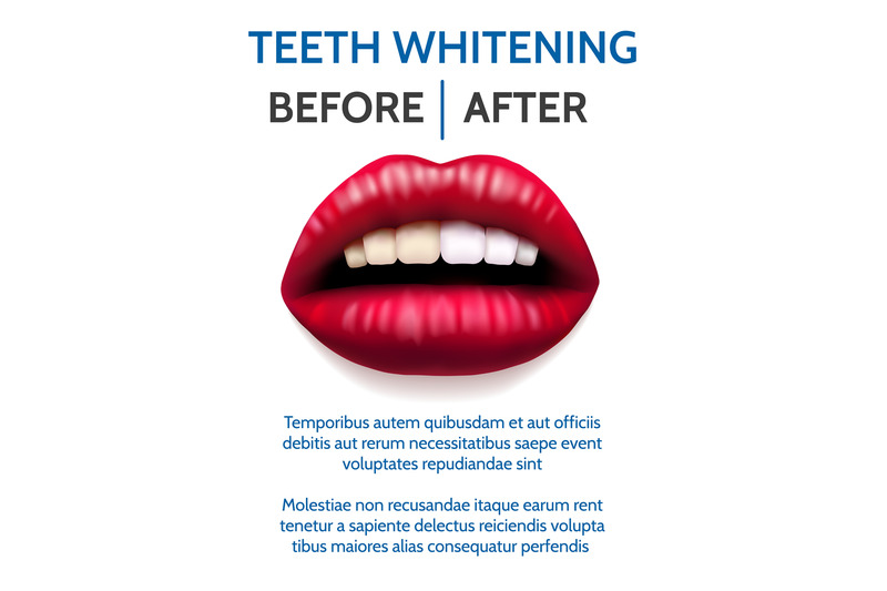 teeth-whitening-poster