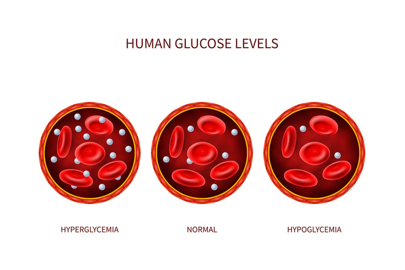 human-glucose-levels-hyperglycemia-normal-hypoglycemia-hematology-v